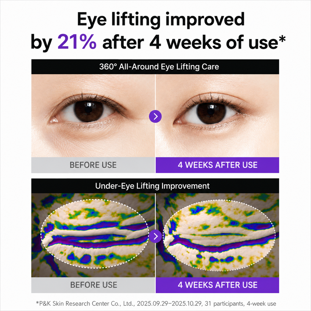 Centellian24 - 360º Shot PDRN Lifting Eye Cream 30ml